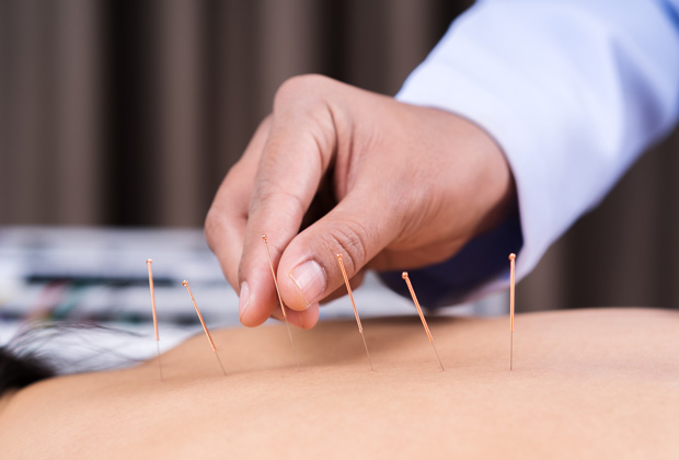 L’acupuncture abdominale